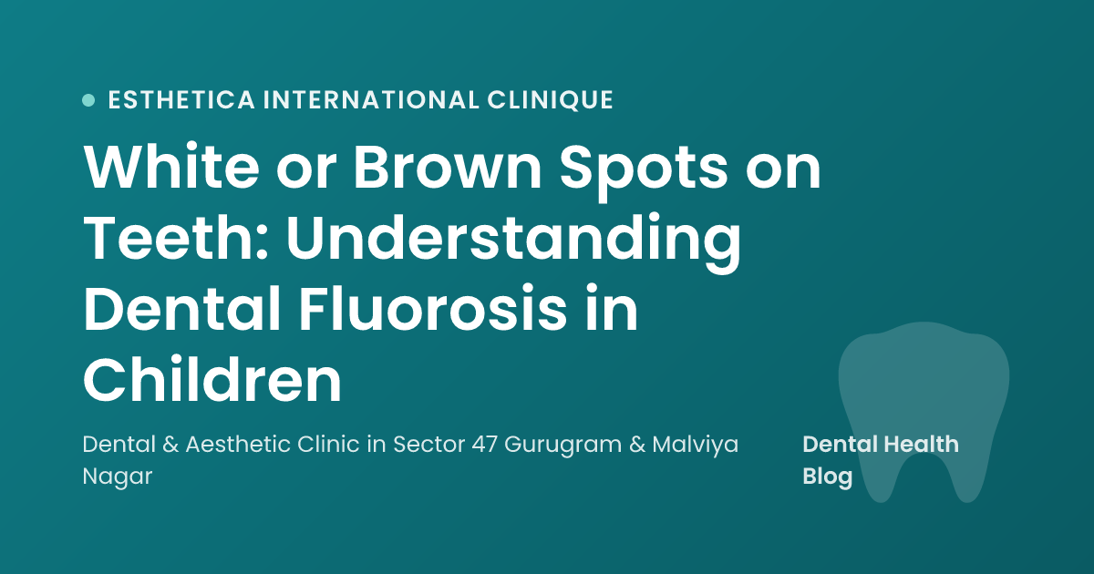 White or Brown Spots on Teeth: Understanding Dental Fluorosis in Children
