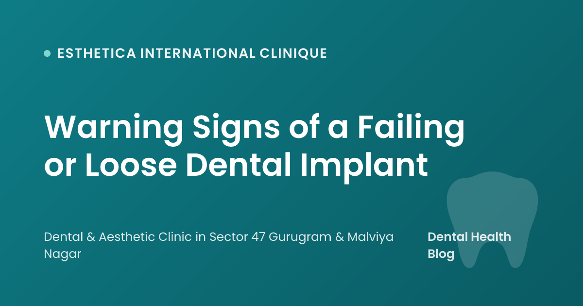 Warning Signs of a Failing or Loose Dental Implant