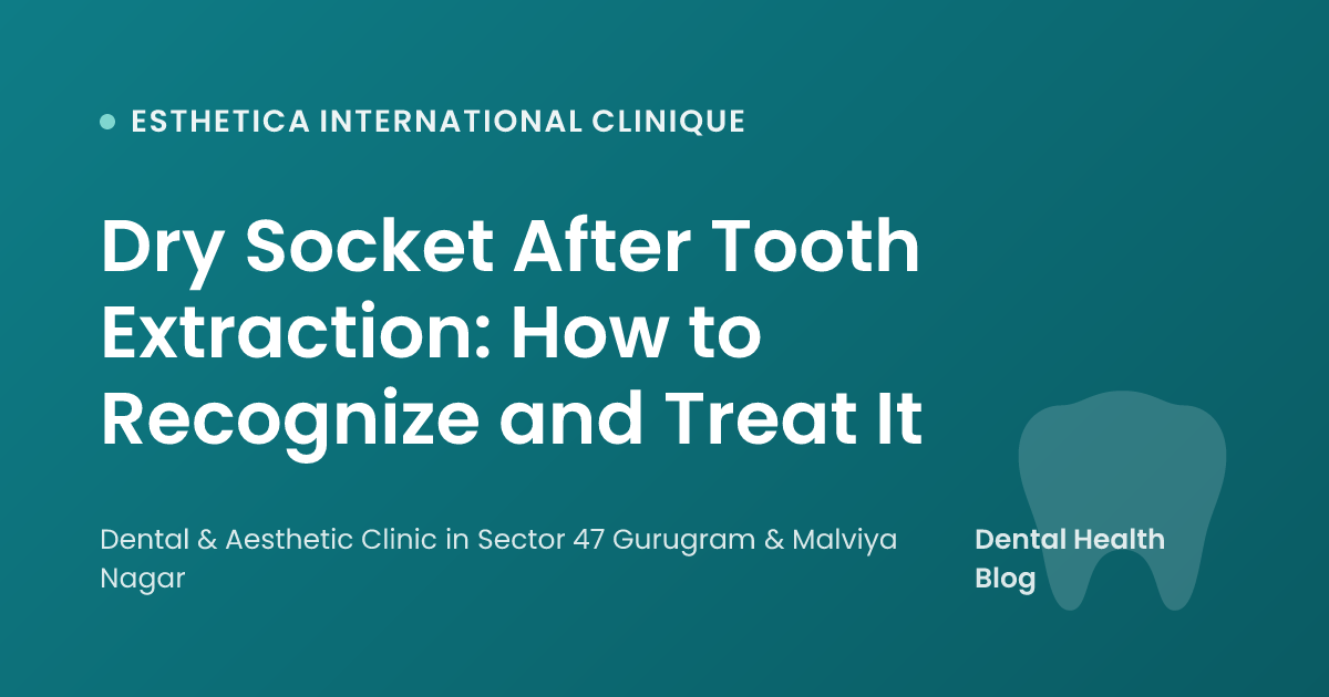 Dry Socket After Tooth Extraction: How to Recognize and Treat It