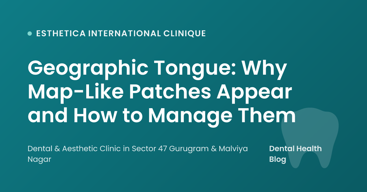 Geographic Tongue: Why Map-Like Patches Appear and How to Manage Them