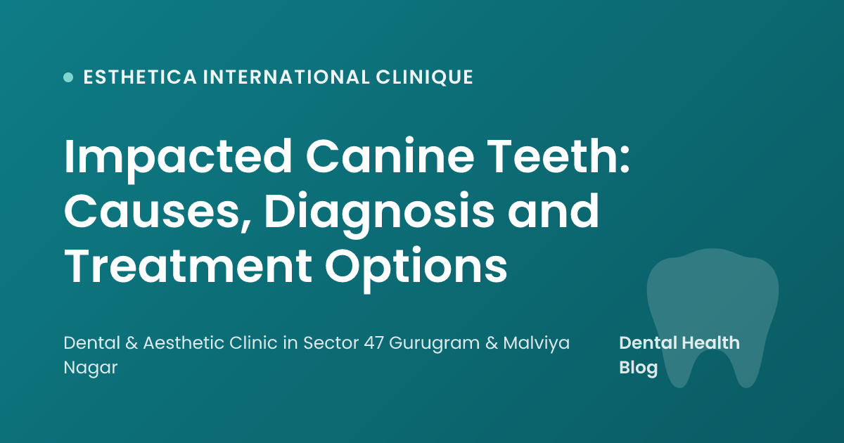 Impacted Canine Teeth: Causes, Diagnosis and Treatment Options