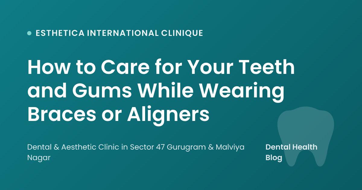 How to Care for Your Teeth and Gums While Wearing Braces or Aligners