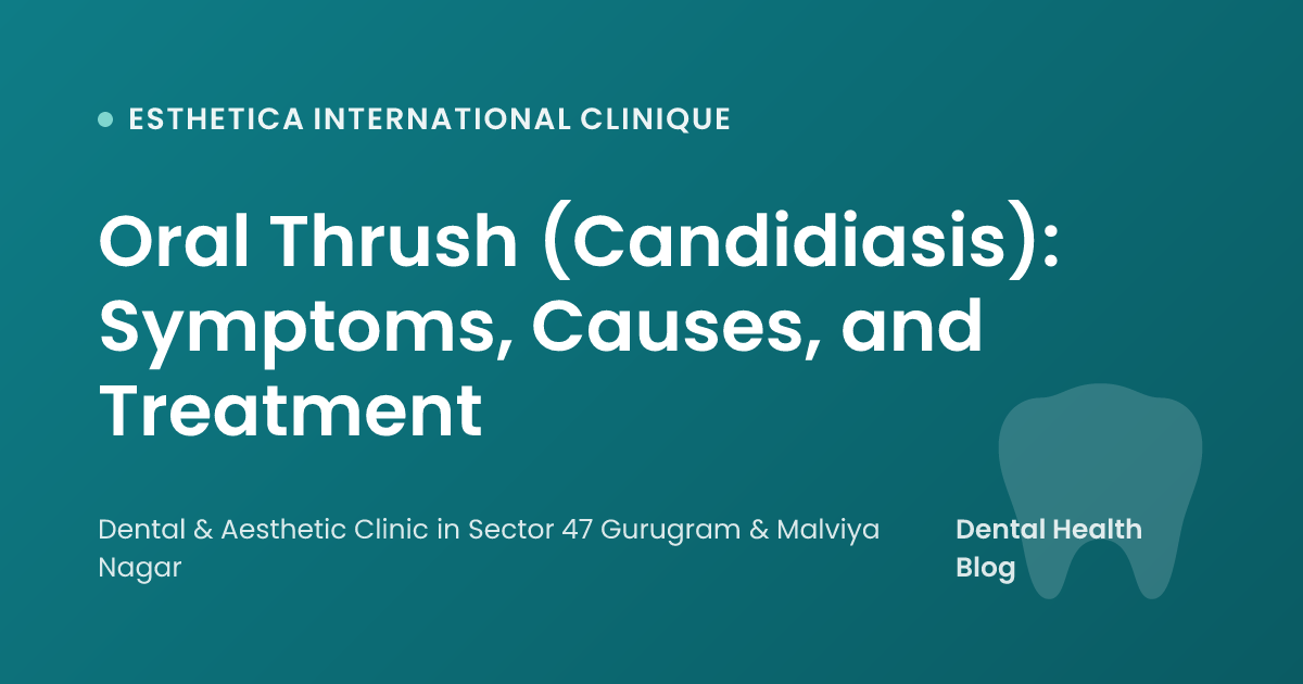 Oral Thrush (Candidiasis): Symptoms, Causes, and Treatment