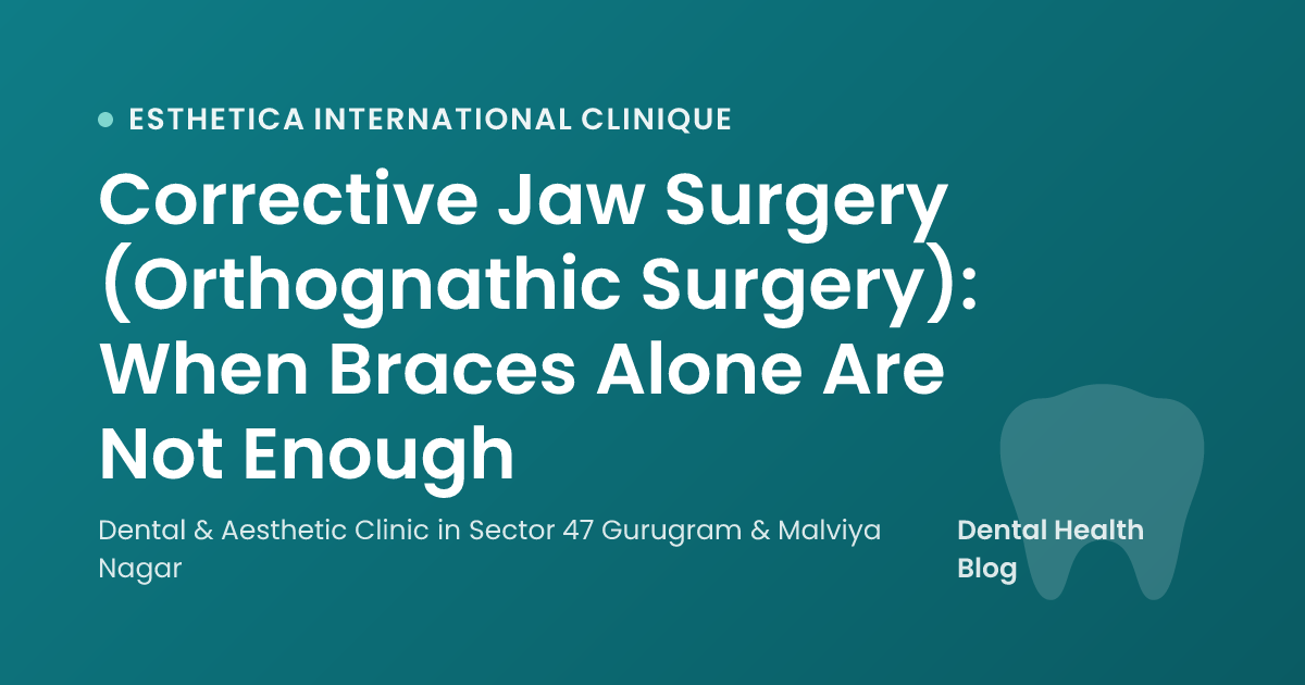 Corrective Jaw Surgery (Orthognathic Surgery): When Braces Alone Are Not Enough