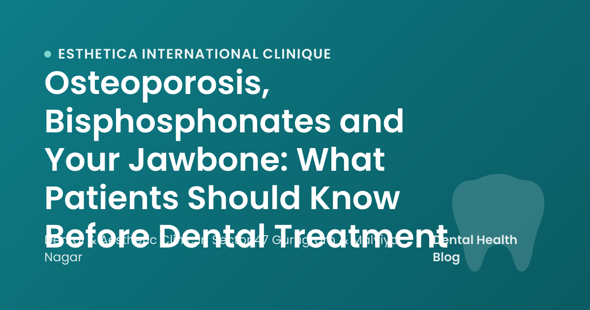 Osteoporosis, Bisphosphonates and Your Jawbone: What Patients Should Know Before Dental Treatment