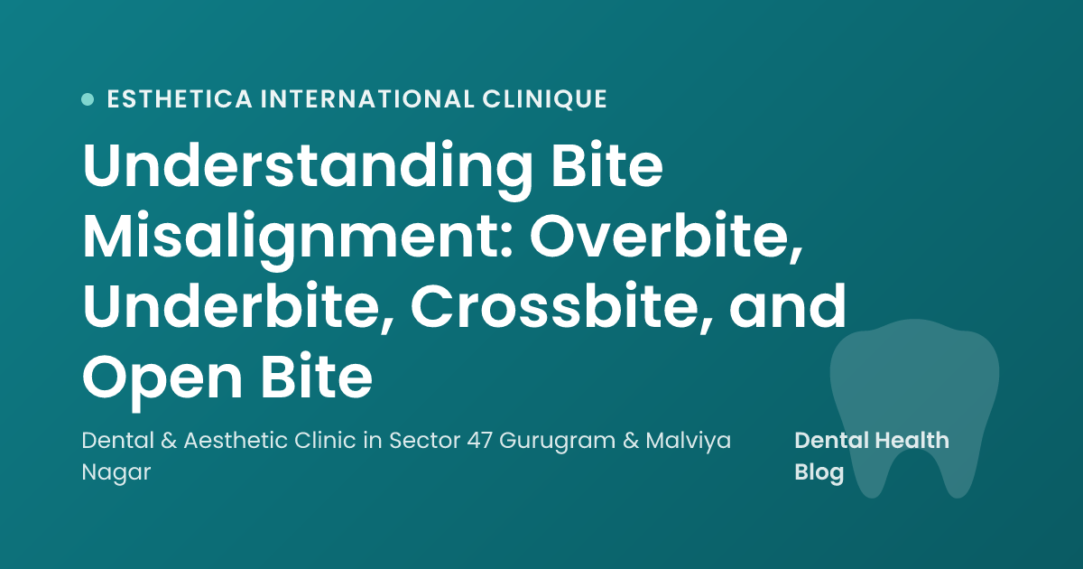 Understanding Bite Misalignment: Overbite, Underbite, Crossbite, and Open Bite