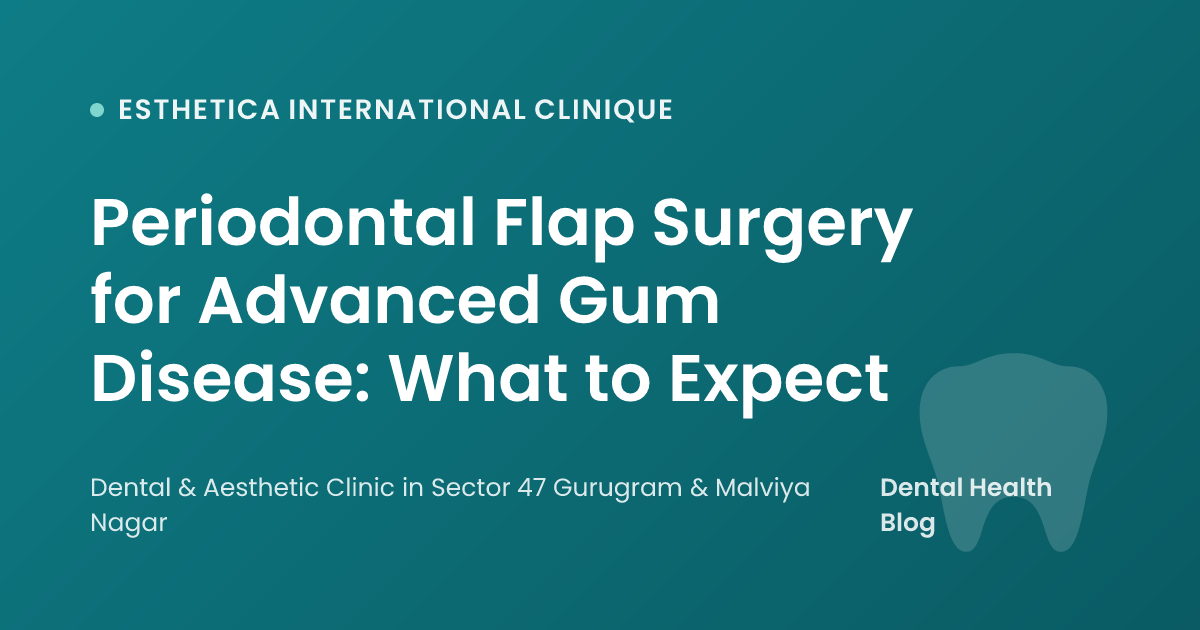 Periodontal Flap Surgery for Advanced Gum Disease: What to Expect