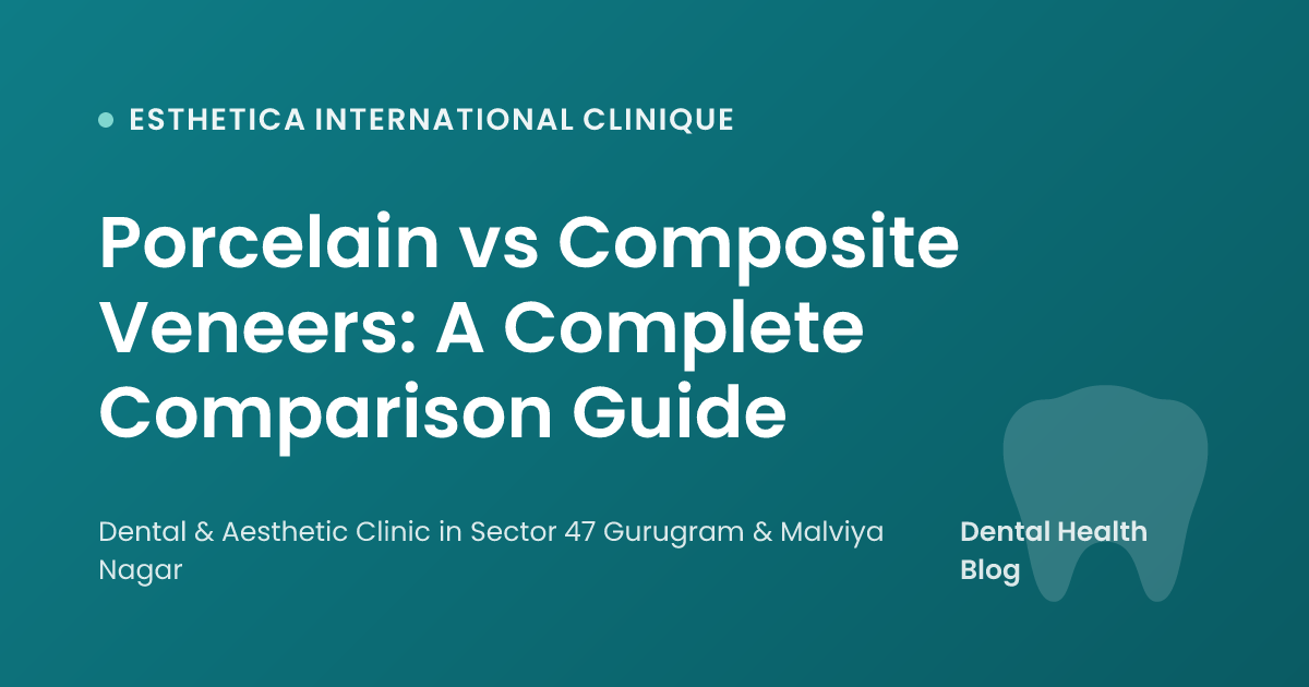 Porcelain vs Composite Veneers: A Complete Comparison Guide