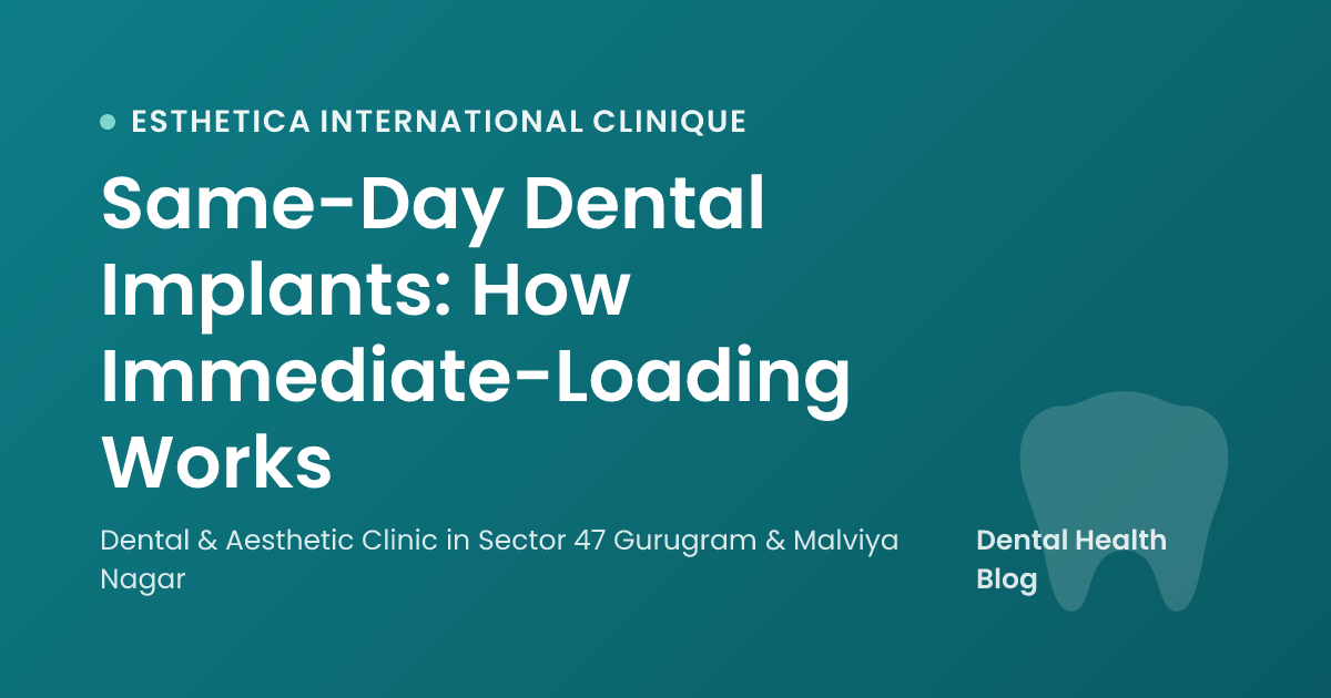 Same-Day Dental Implants: How Immediate-Loading Works