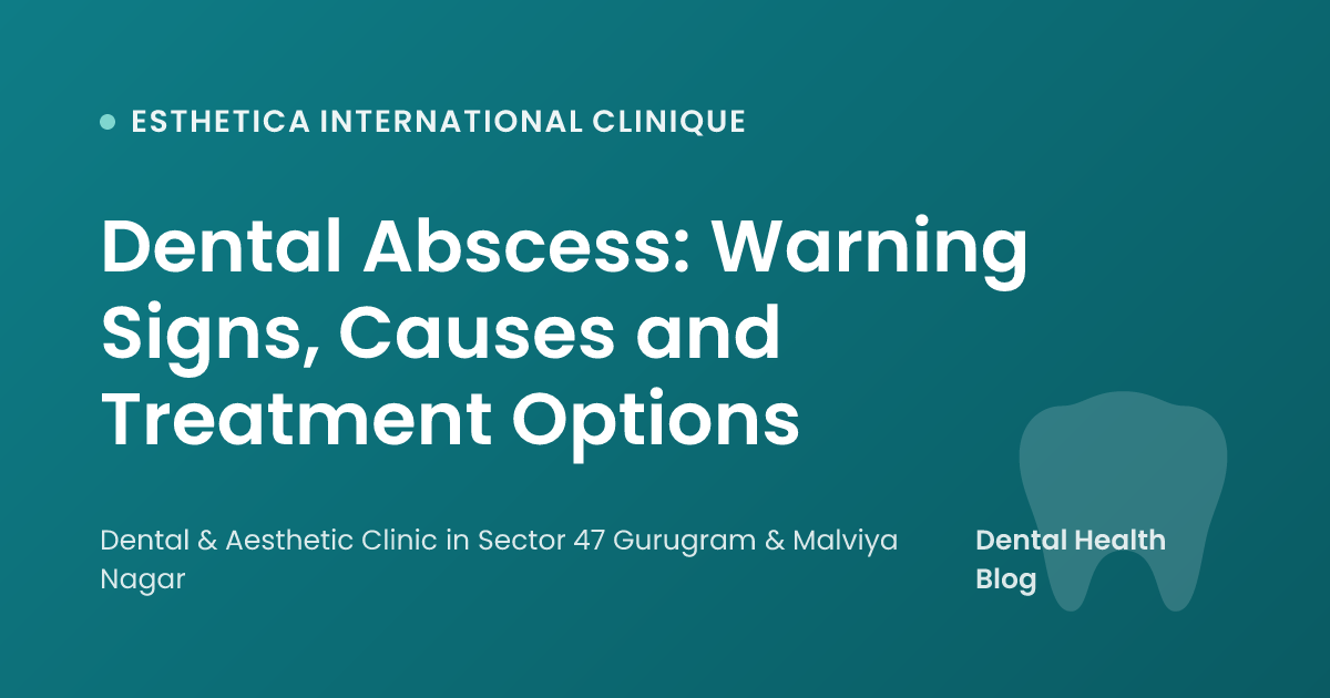Dental Abscess: Warning Signs, Causes and Treatment Options